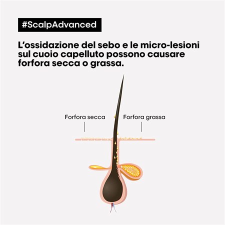 L'Oreal Scalp Advanced Anti-Dandruff Shampoo - Antiforfora e Seboregolatore 500ml in Capelli