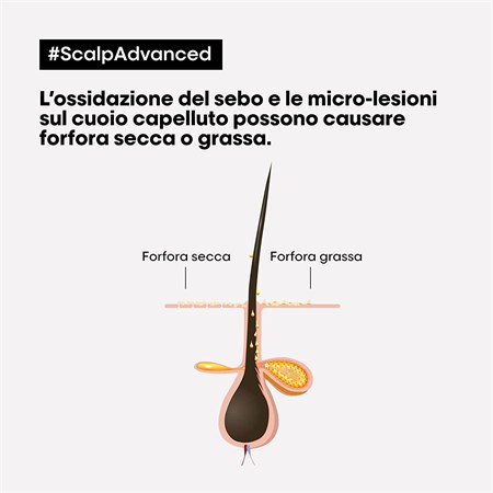 L'Oreal Serie Expert Scalp Advanced Anti-Dandruff Shampoo - Antiforfora e Seboregolatore 300ml in Capelli