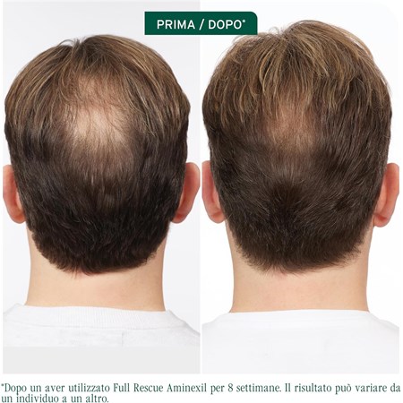 MATRIX Biolage Trattamento Anti-Caduta in Fiale per Capelli Fini 6x10ml in Capelli